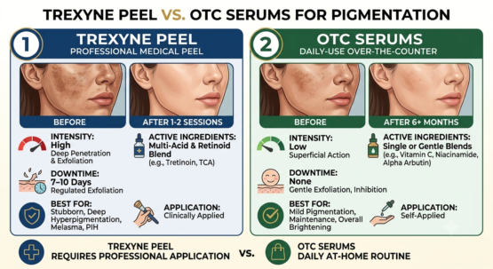 Trexyne Peel vs. OTC Serums for Pigmentation