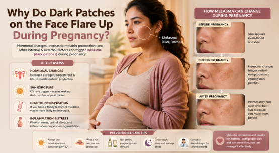 Why Do Dark Patches on the Face Flare Up During Pregnancy