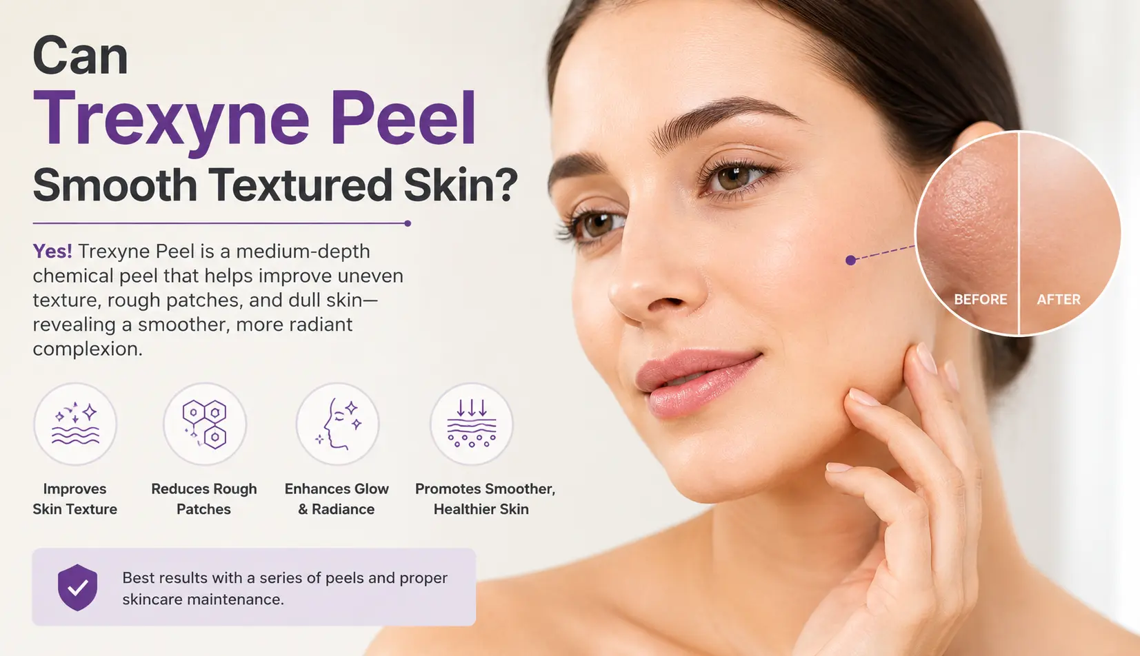 Can Trexyne Peel Smooth Textured Skin