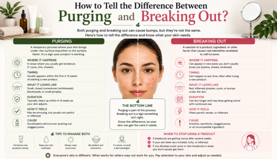 How to Tell the Difference Between Purging and Breaking Out