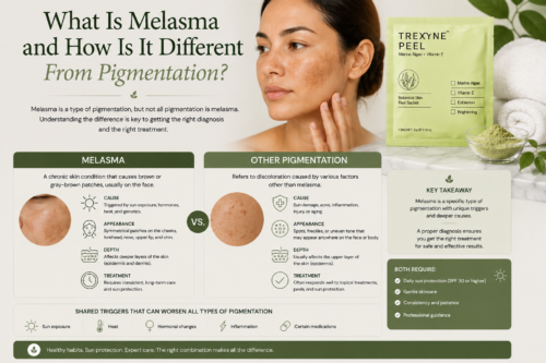 What Is Melasma and How Is It Different From Pigmentation
