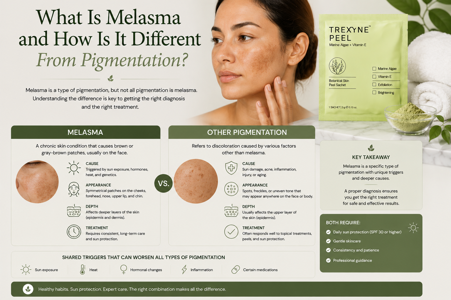 What Is Melasma and How Is It Different From Pigmentation