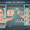 Is Trexyne Peel Suitable for Clients With Very Oily Skin